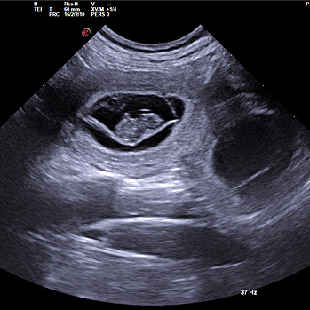 Unser D-Wurf ist unterwegs